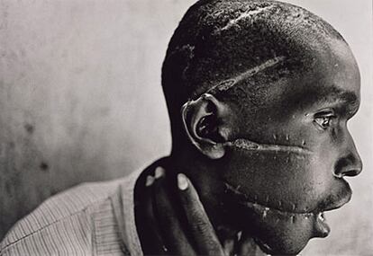 Es el rostro de la guerra, de la barbarie. Este hombre fue marcado por la milicia de los hutus sólo por la sospecha de ser simpatizante de los rebeldes tutsis. Él es una víctima más de una guerra, de la violencia en África, la muestra de una operación de limpieza étnica a machetazos y pedradas en Ruanda. El genocidio de los tutsis causó más de 800.000 muertos, el 11% de la población total.