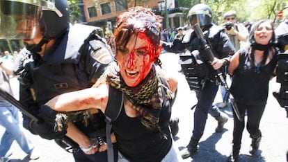 Seventy-six people were injured and eight arrested in Wednesday’s protest.