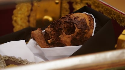 Detalle de la cabeza de Santa Teresa de Jesús durante el acto de apertura de veneración pública, en el convento Padres Carmelitas Descalzos, este domingo en Alba de Tormes (Salamanca).