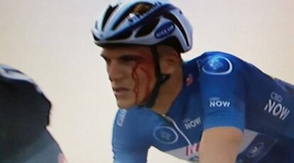 Kittel, tras sufrir la agresi&oacute;n.