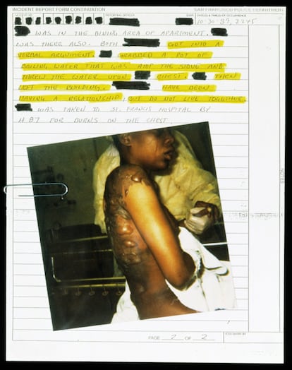 'Collage de informe y fotografía policial' de la serie 'Archives of Abuse', (San Francisco, 1991).
