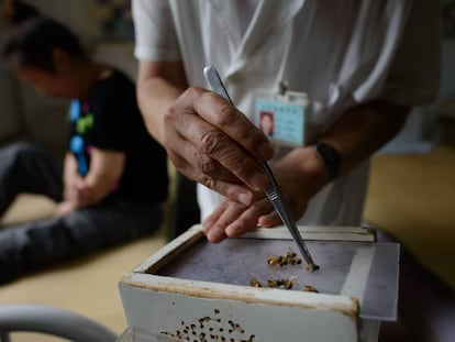 La medicina tradicional china usa aguijones de abeja contra el cáncer.