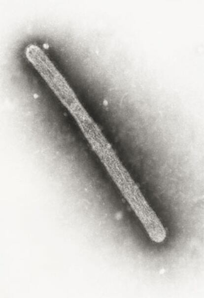 El virus aviar H5N1, visto al microscopio electrónico.