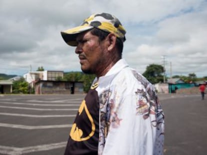 Seguidores del presidente han atacado a opositores con un compuesto químico corrosivo en Boaco en un nuevo brote de violencia en Nicaragua