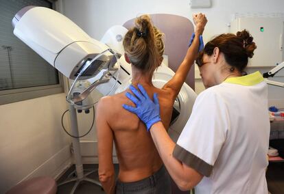 Una mujer se hace una mamografía.