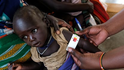Un médico mide el brazo de un niño en Kotido, Uganda, el 23 de julio de 2025