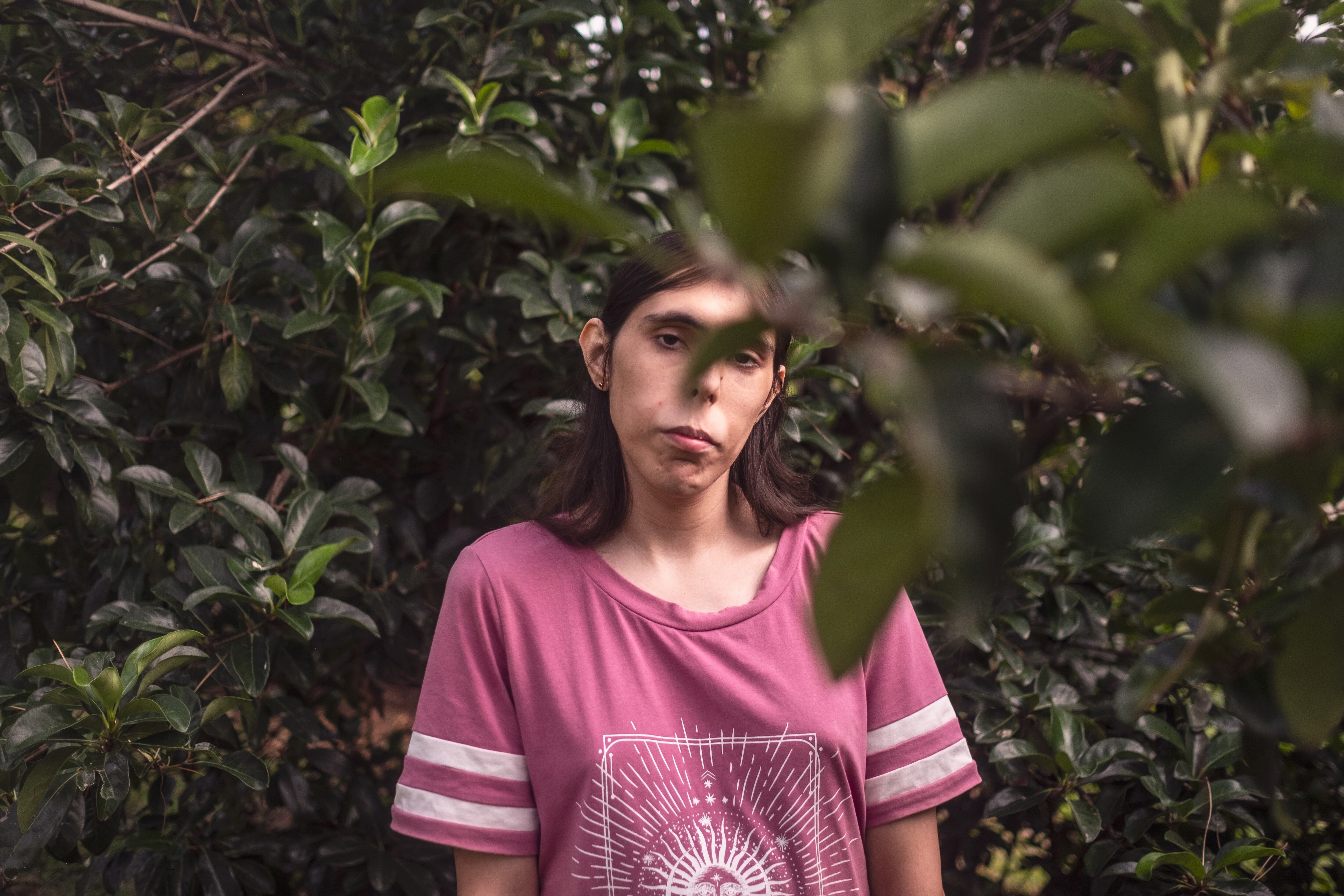 Lena Blanco, paciente de la UIG (Unidad de Identidad de Género), fotografiada en el parque del Oeste de Madrid.