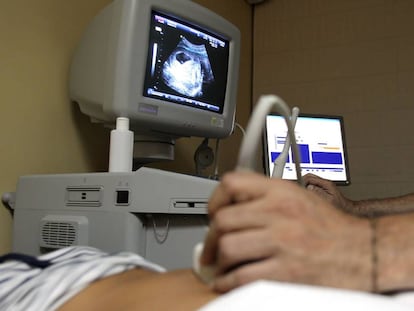 Un sanitario realiza una ecografía, en una imagen de archivo