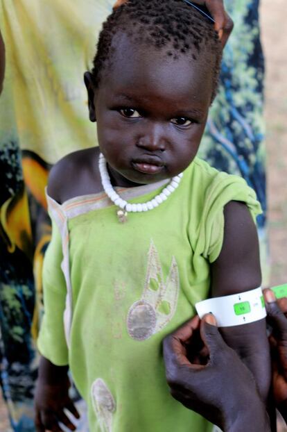 Un niño de la aldea de Kiech Kuon, en Sudán del Sur, durante una revisión médica.