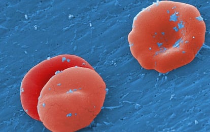 Células de sangre al microscopio.