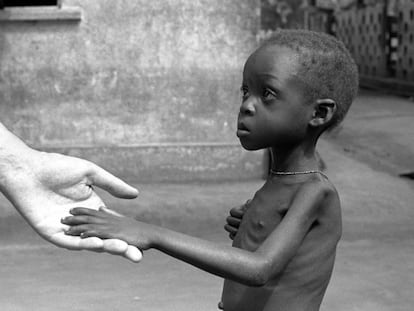 Un ni&ntilde;o durante la hambruna que azot&oacute; en 1962 al territorio de los actuales Togo y Ben&iacute;n, en &Aacute;frica occidental.