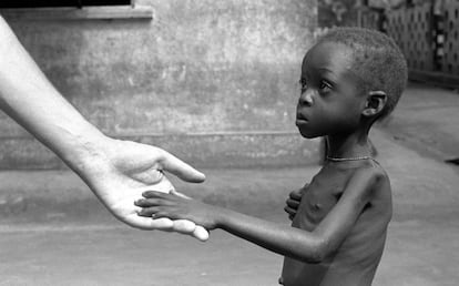 Un niño durante la hambruna que azotó en 1962 al territorio de los actuales Togo y Benín, en África occidental.