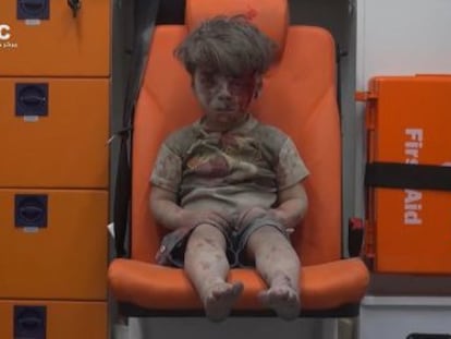 Grupo ativista rebelde Aleppo Media Center divulga imagem de um menino de cinco anos ferido durante um bombardeio recente