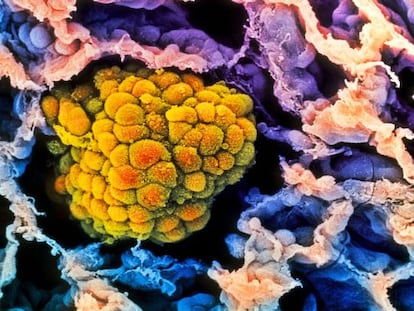 Cinco verdades sobre a “má sorte” de ter câncer
