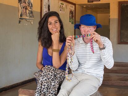 Mafalda Soto junto a Charles, un joven con albinismo de 23 años está siendo tratado por Beyond Suncare.