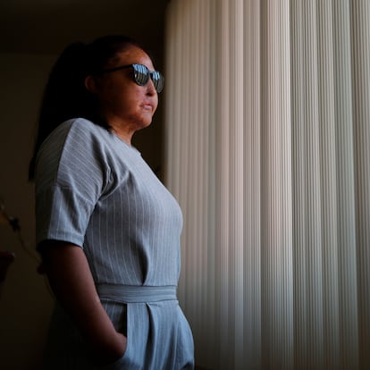 Carmen Sánchez, sobreviviente de un ataque con ácido por parte de su expareja