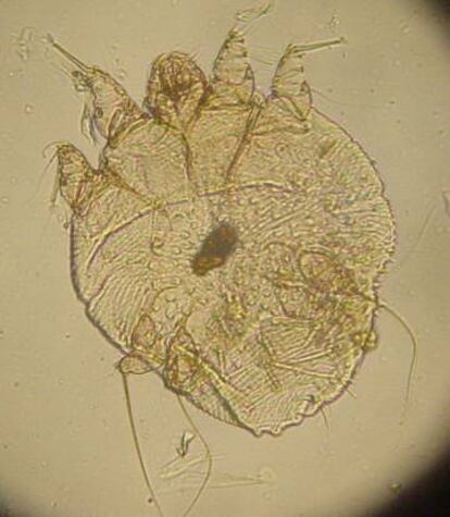 L'insecte de la sarna.