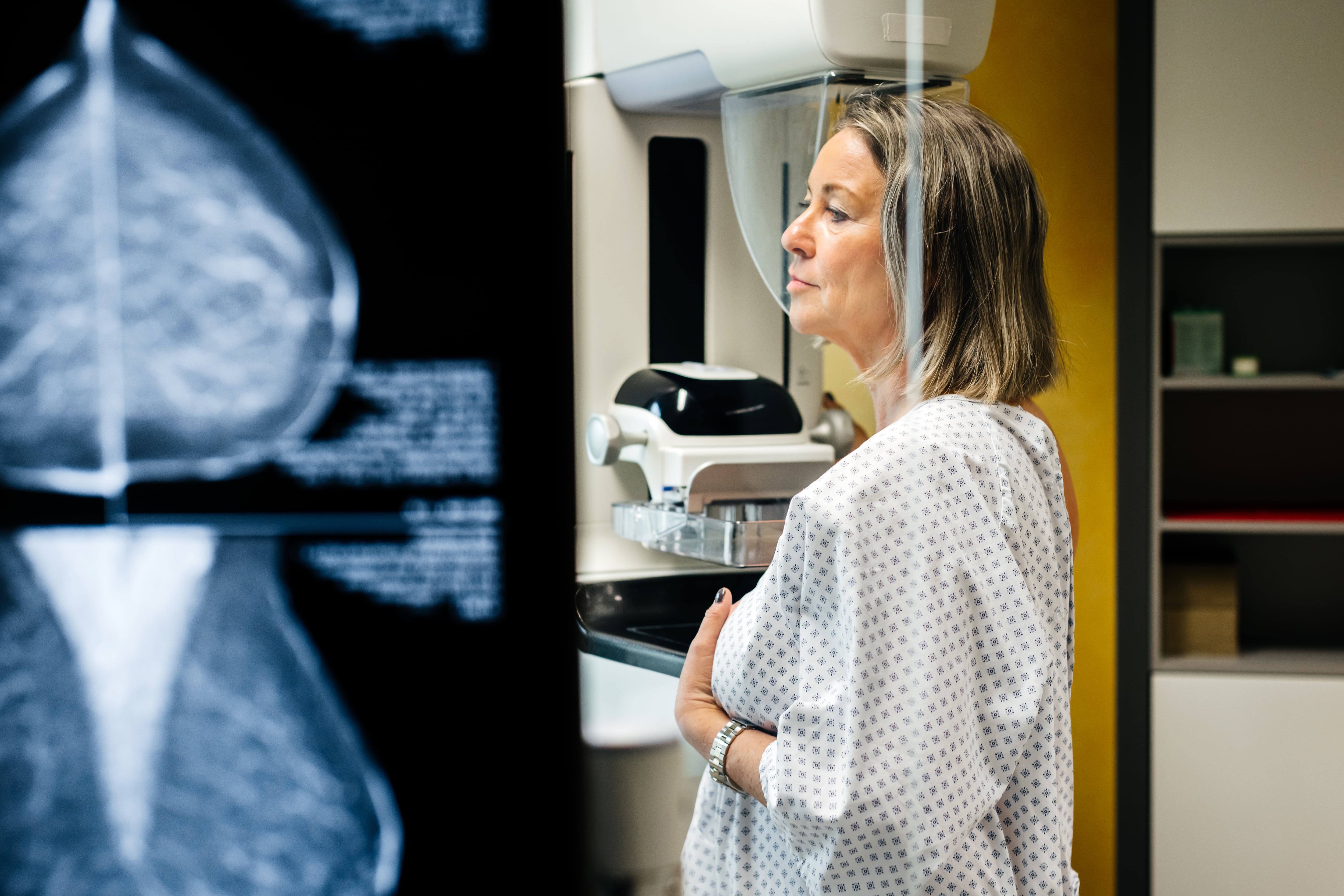 Virus respiratorios como la gripe promueven la metástasis del cáncer
