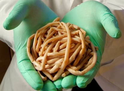Gusanos intestinales extraídos de un niño en Kenia.