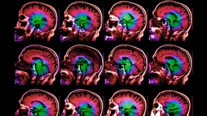 Investigadores de la Universidad de Columbia han descubierto un gen que tiene relación directa con el envejecimiento del cerebro.