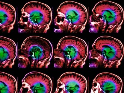 Investigadores de la Universidad de Columbia han descubierto un gen que tiene relación directa con el envejecimiento del cerebro.