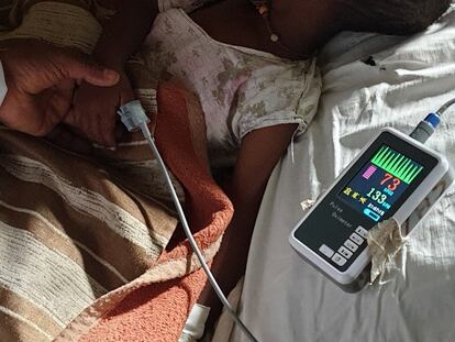 A doctor at Gambo Hospital in rural Ethiopia measures the blood oxygen level of a patient with bronchiolitis.