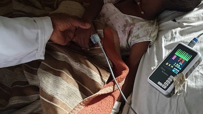 A doctor at Gambo Hospital in rural Ethiopia measures the blood oxygen level of a patient with bronchiolitis.