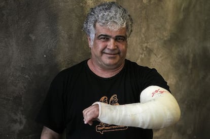 Jaled Jalifa exhibe el brazo que le rompió la policía en una manifestación en Damasco. La foto fue tomada esta semana en Madrid.