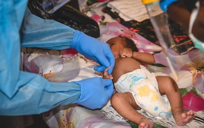 Un bebé recibe tratamiento contra Mpox en Freetown, Sierra Leona. 