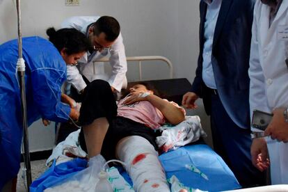 Doctors treat a Syrian woman injured from a drone attack that hit a packed military graduation ceremony in the central city of Homs, Syria, Oct. 5, 2023.