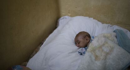 Jose Wesley, afectado por microcefalia, duerme en la cama de su madre en Bonito, estado de Pernambuco, Brasil.