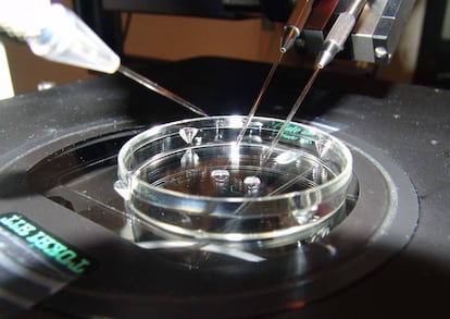 Proceso de fecundación in vitro