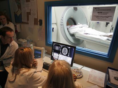 Un grupo de médicos hace un escáner para determinar el alcance de la lesión cerebral de un paciente después de un ictus.
