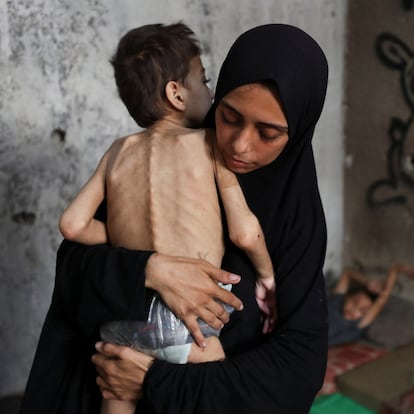 Displaced Palestinian mother Samah Matar holds her malnourished son Youssef, who suffers from cerebral palsy, at a school where they shelter amid a hunger crisis, in Gaza City, July 24, 2025. REUTERS/Mahmoud Issa