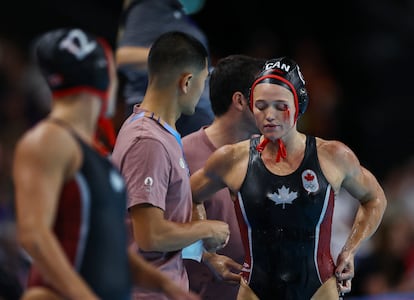 La canadiense Blaire McDowell se lesiona durante el partido contra Italia.  