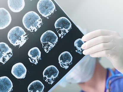 A doctor studies a patient's brain damage.