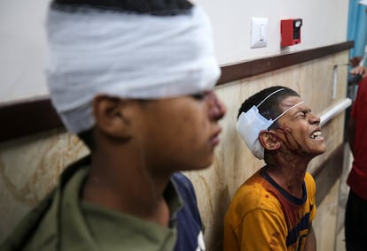 Dos niños palestinos heridos, tras ser atendidos en el hospital Al Aqsa en Deir Al Bala, en el centro de la Franja, este jueves.