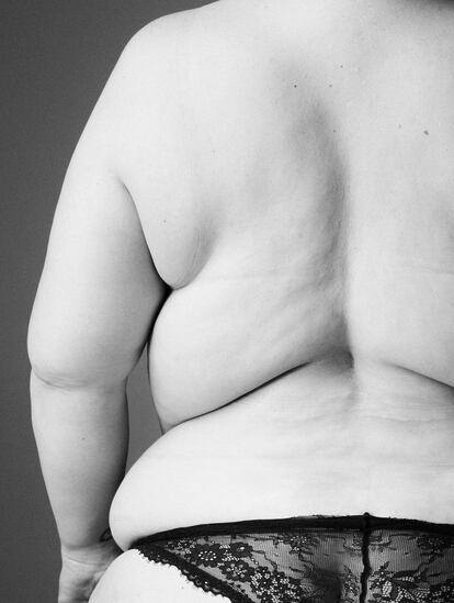 Un 16% de los adultos en el mundo sufre obesidad, según la OMS.