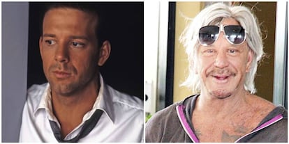 Mickey Rourke antes y después de sus múltiples operaciones de cirugía estética.