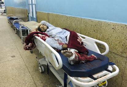 Un hombre que resultó herido en los ataques mortales fuera del aeropuerto de Kabul, Afganistán, yace en una cama en un hospital.