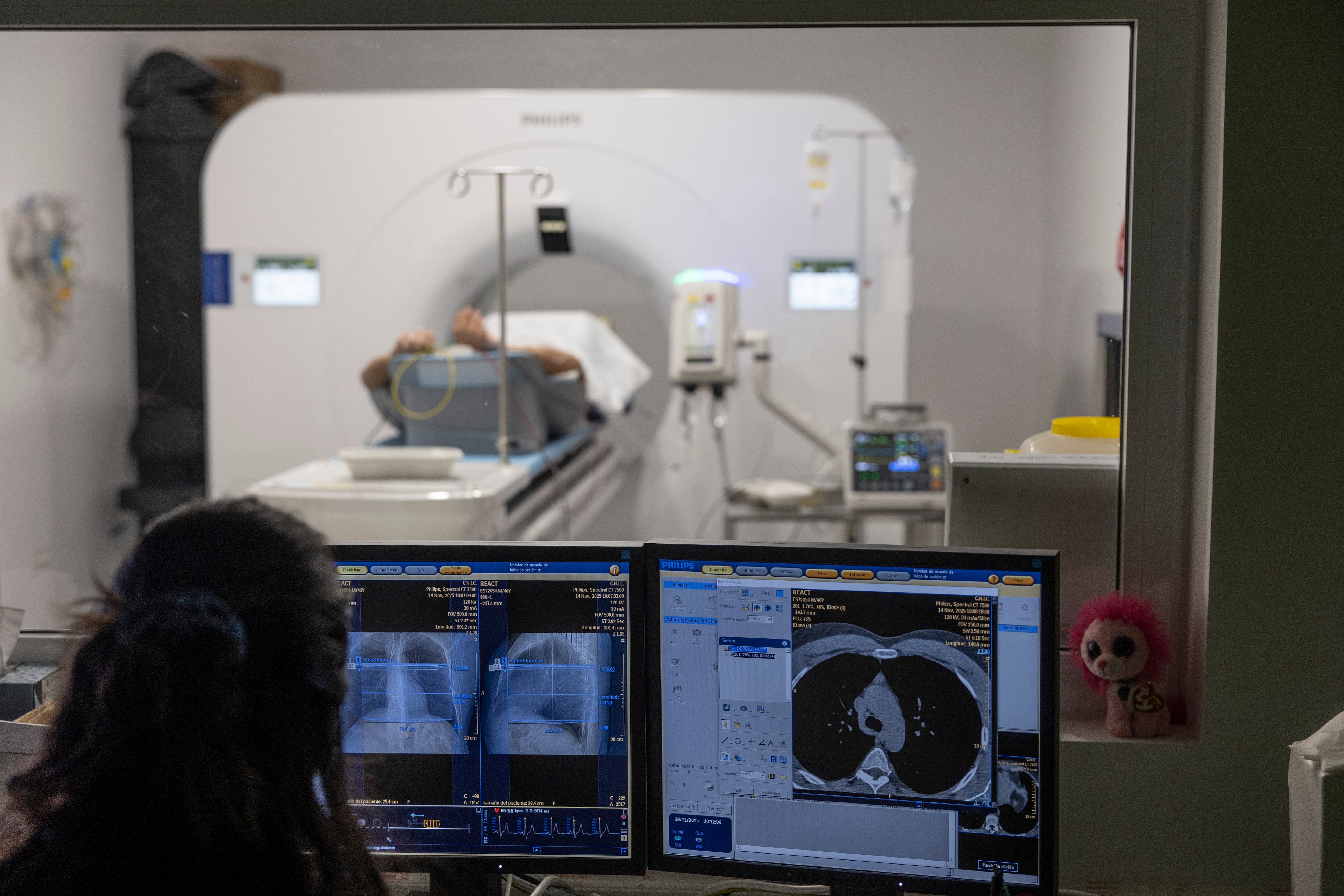 Análisis de las arterias del corazón mediante una angiotomografía computarizada, en el CNIC, en Madrid.