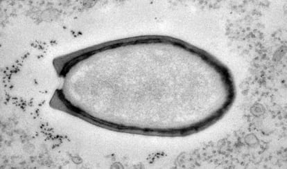 Un pandoravirus.