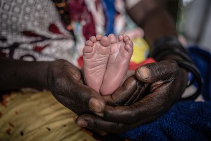 Epifanía, paciente del Hospital Central de Sahr, Chad, sostiene los pies de su hijo recién nacido.