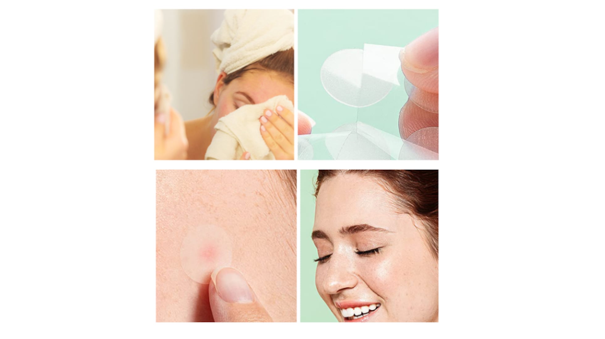 Así son los parches absorbentes de acné con ácido salicílico para combatir  las espinillas | Belleza | Escaparate | EL PAÍS, image size:1960x1100