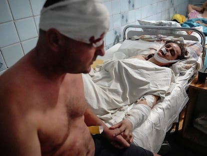 Una pareja herida en el bombardeo del centro comercial de Kremenchuk, Ucrania, el pasado 27 de junio.