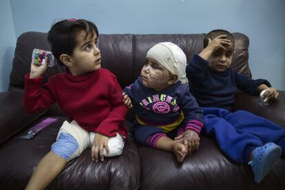 Tras ver cómo las bombas destruían su hogar a principios del año pasado, estos tres hermanos y su familia pudieron escapar de la provincia siria de Dara’a cruzando hasta Jordania. Una vez en Ammán, fueron admitidos en el hospital de MSF, donde recibieron tratamiento quirúrgico.
