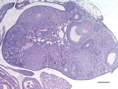 Ovario de uno de los ratones modificados para producir más óvulos.