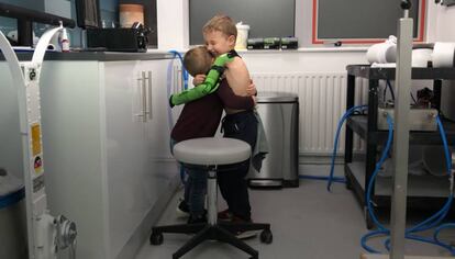 Jacob Scrimshaw de cinco años es el primer niño de Reino Unido que tiene una prótesis funcional fija como brazo.