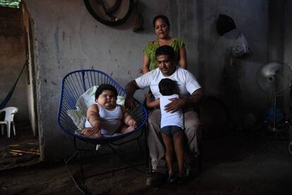 Luis Gonzales, edad 10 meses, peso 28 kilos. (México)