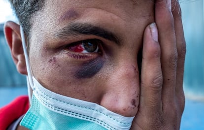 A Moroccan man attacked by a vigilante group.